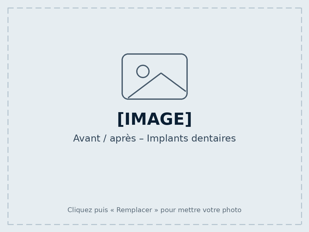 Before / after – Dental implants