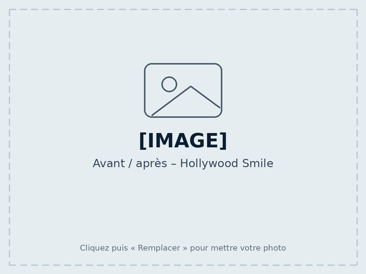 Before / after – Hollywood Smile