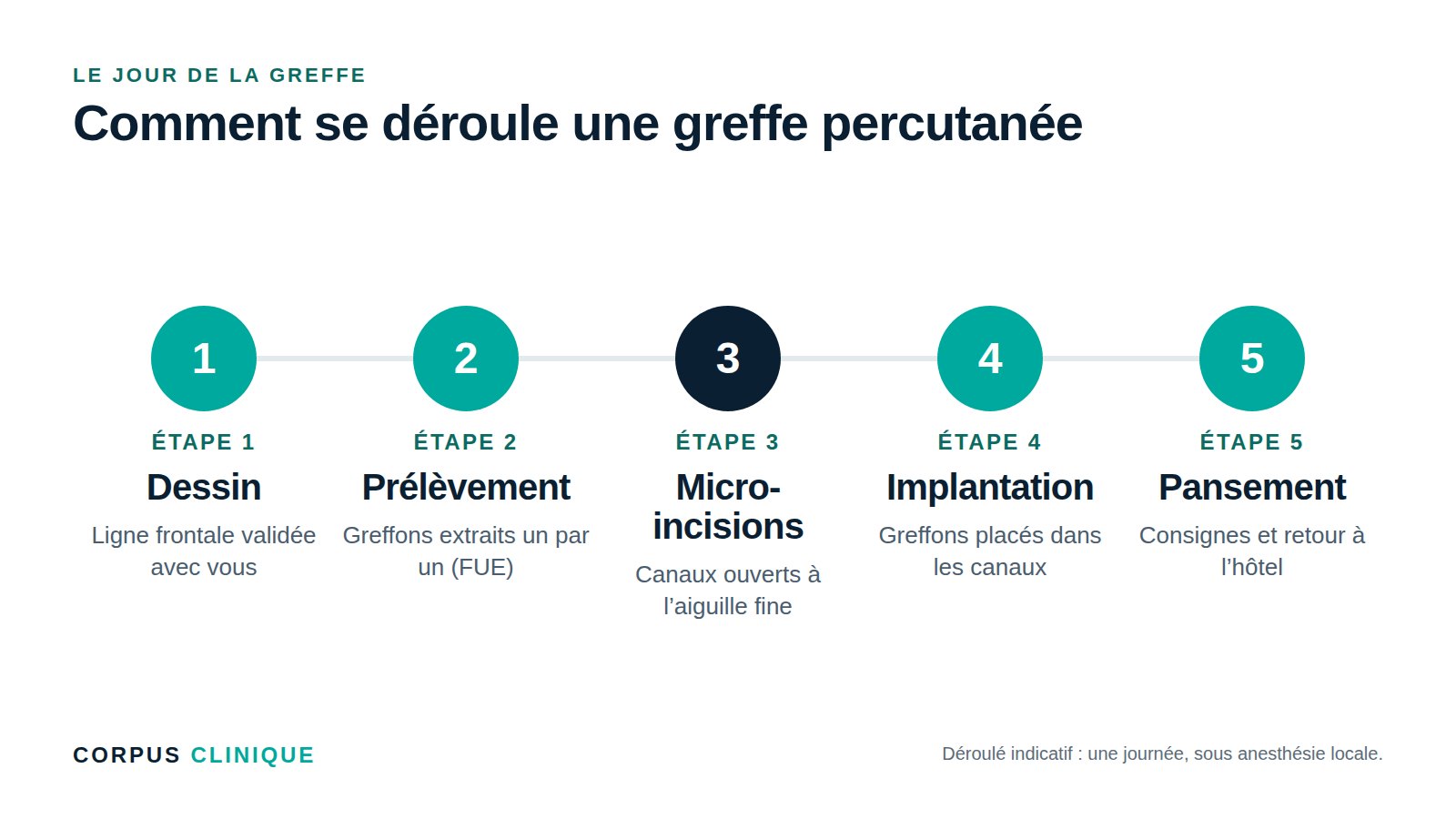 Les étapes d’une greffe de cheveux percutanée