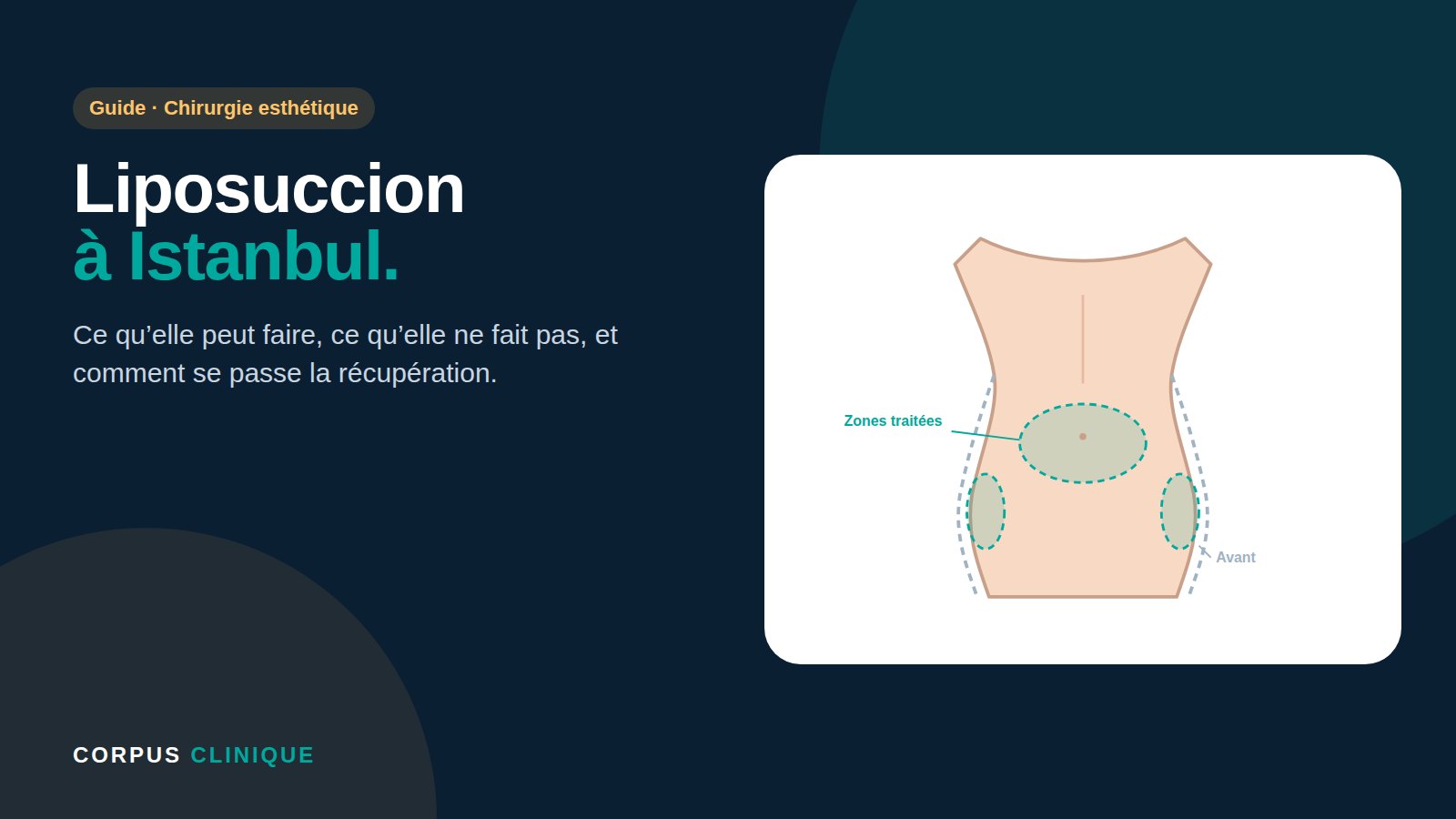 Liposuccion à Istanbul