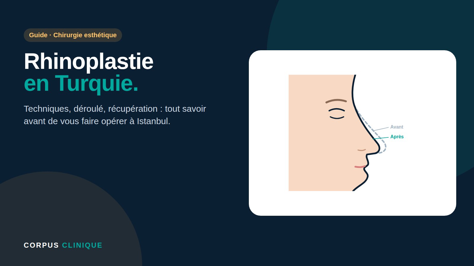 Rhinoplastie en Turquie